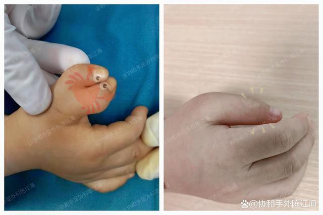 info-640-427 info-640-427