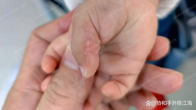 info-1242-699 info-1242-699