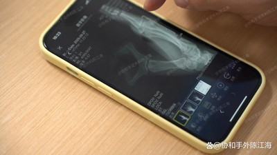 info-1242-699 info-1242-699